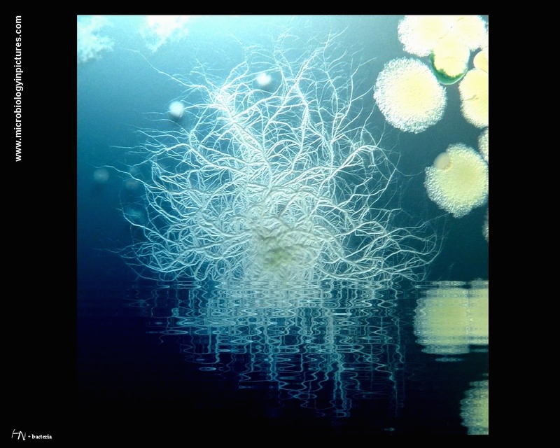 medusa-like bacterial colonies